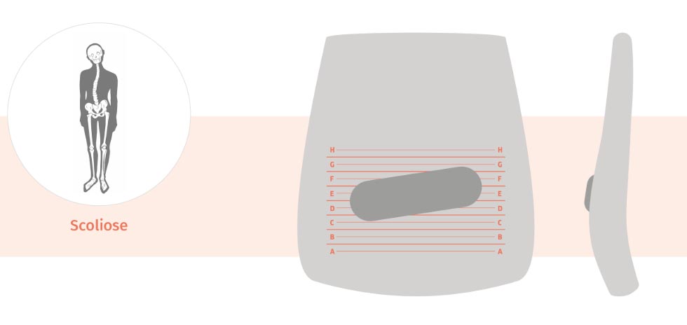ergonomische bureaustoel rugklachten bij scoliose