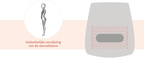 bureaustoel-rugklachten-stijve-wervelkolom
